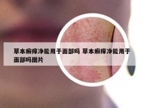 草本癣痒净能用于面部吗 草本癣痒净能用于面部吗图片