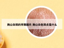 胸口白斑的早期图片 胸口白色斑点是什么