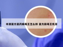 丰源苗方苗药癣毒王怎么样 苗方藓毒王乳膏