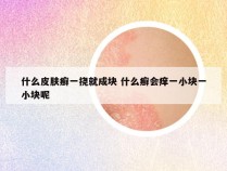 什么皮肤癣一挠就成块 什么癣会痒一小块一小块呢