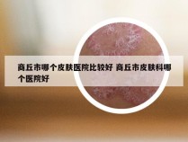 商丘市哪个皮肤医院比较好 商丘市皮肤科哪个医院好