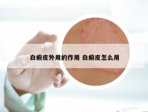 白癣皮外用的作用 白癣皮怎么用