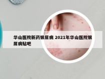 华山医院新药银屑病 2021年华山医院银屑病贴吧