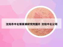 沈阳市中北银屑病研究院图片 沈阳中北公司