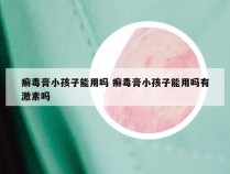 癣毒膏小孩子能用吗 癣毒膏小孩子能用吗有激素吗