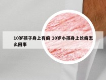 10岁孩子身上有癣 10岁小孩身上长癣怎么回事