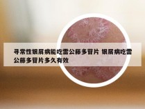 寻常性银屑病能吃雷公藤多苷片 银屑病吃雷公藤多苷片多久有效