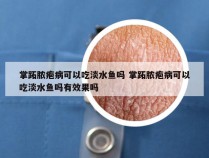 掌跖脓疱病可以吃淡水鱼吗 掌跖脓疱病可以吃淡水鱼吗有效果吗