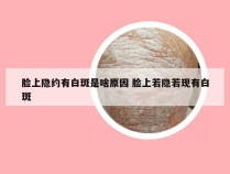 脸上隐约有白斑是啥原因 脸上若隐若现有白斑