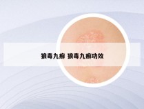 狼毒九癣 狼毒九癣功效