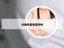 白癜风基因遗传吗