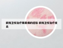 欧阳卫权治疗银屑病的经验 欧阳卫权治疗皮炎