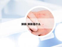 鲜藓 鲜藓是什么