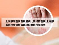 上海那家医院看银屑病比较好的医院 上海那家医院看银屑病比较好的医院有哪些