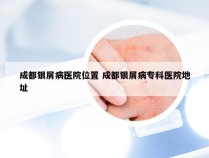 成都银屑病医院位置 成都银屑病专科医院地址