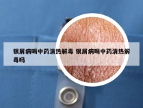 银屑病喝中药清热解毒 银屑病喝中药清热解毒吗