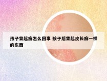 孩子背起癣怎么回事 孩子后背起皮长癣一样的东西