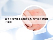 六个月孩子身上长癣怎么办 六个半月宝宝身上长藓