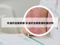 辛温药治银屑病 辛温药治银屑病效果好吗