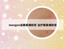 moogoo治银屑病软膏 治疗银屑病软膏