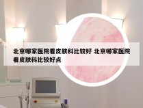 北京哪家医院看皮肤科比较好 北京哪家医院看皮肤科比较好点