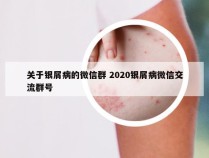 关于银屑病的微信群 2020银屑病微信交流群号