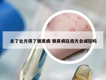 去了北方得了银屑病 银屑病在南方会减轻吗