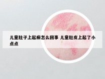 儿童肚子上起癣怎么回事 儿童肚皮上起了小点点