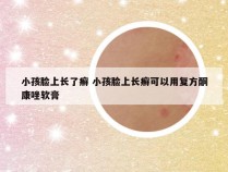 小孩脸上长了癣 小孩脸上长癣可以用复方酮康唑软膏