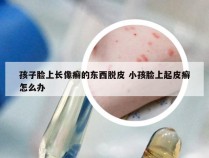 孩子脸上长像癣的东西脱皮 小孩脸上起皮癣怎么办