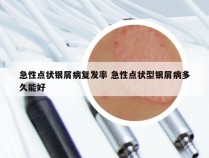 急性点状银屑病复发率 急性点状型银屑病多久能好