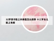 12岁孩子脸上长癣是怎么回事 十二岁女儿脸上有癣