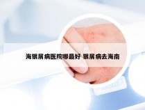 海银屑病医院哪最好 银屑病去海南