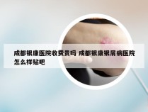 成都银康医院收费贵吗 成都银康银屑病医院怎么样贴吧