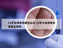 12岁女孩有头癣怎么办 12岁小女孩有头皮屑正常吗