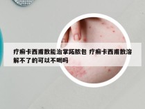 疗癣卡西甫散能治掌跖脓包 疗癣卡西甫散溶解不了的可以不喝吗