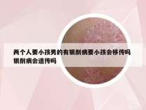 两个人要小孩男的有银削病要小孩会移传吗 银削病会遗传吗