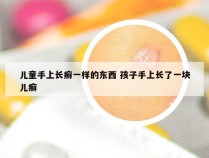 儿童手上长癣一样的东西 孩子手上长了一块儿癣