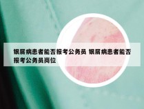 银屑病患者能否报考公务员 银屑病患者能否报考公务员岗位