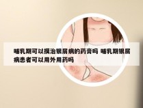 哺乳期可以摸治银屑病的药膏吗 哺乳期银屑病患者可以用外用药吗