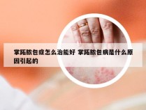 掌跖脓包症怎么治能好 掌跖脓包病是什么原因引起的