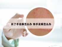 长了手足癣怎么办 有手足癣怎么办