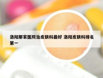 洛阳那家医院治皮肤科最好 洛阳皮肤科排名第一