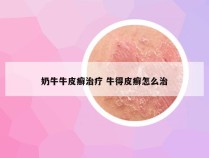 奶牛牛皮癣治疗 牛得皮癣怎么治