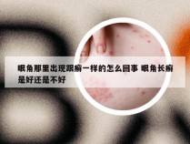 眼角那里出现跟癣一样的怎么回事 眼角长癣是好还是不好