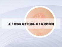 身上开始长癣怎么回事 身上长藓的原因