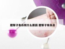 腮帮子有白斑什么原因 腮帮子有白点