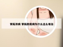 掌跖浓病 掌跖脓疱病为什么这么难治