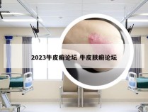 2023牛皮癣论坛 牛皮肤癣论坛