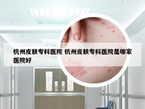 杭州皮肤专科医院 杭州皮肤专科医院是哪家医院好